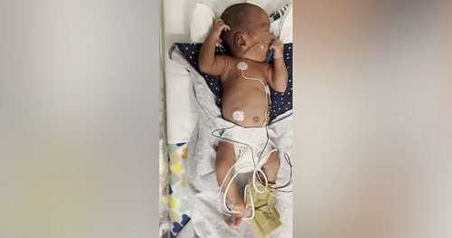 Black Newborn Baby With Fractured Leg Sparks Child Abuse Investigation at Virginia Hospital Black Newborn Baby With Fractured Leg Sparks Child Abuse Investigation at Virginia Hospital
